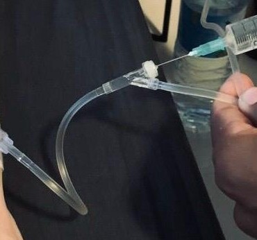 Administration of IV fluids